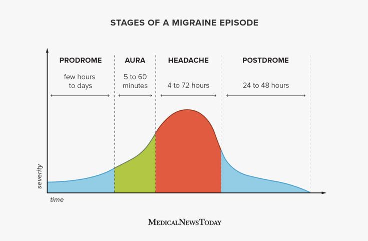 Migraine Treatment