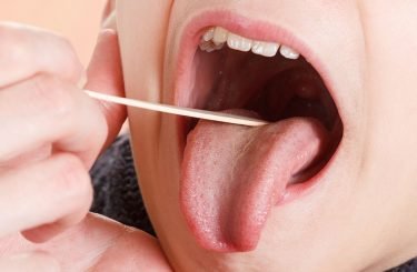 children's tonsillectomies