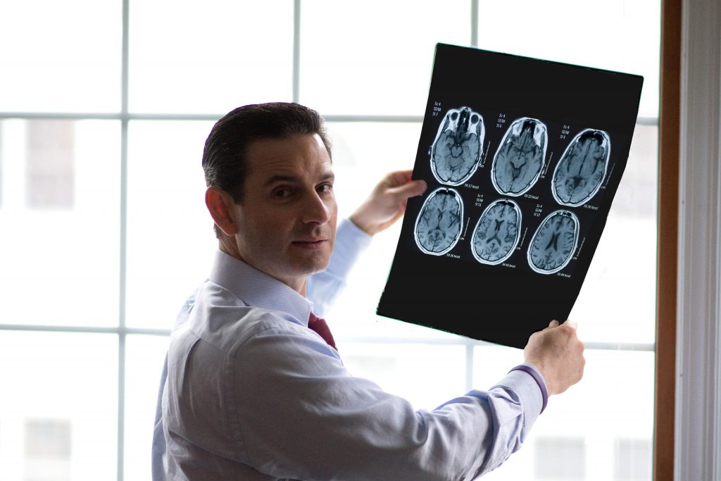 New Jersey traumatic brain injury attorney